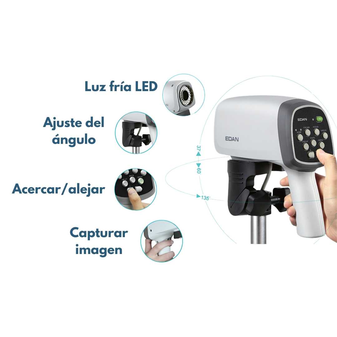 SERIES SD3 C6 HD ULTRASONIC VIDEO COLPOSCOPE - Imagen 6